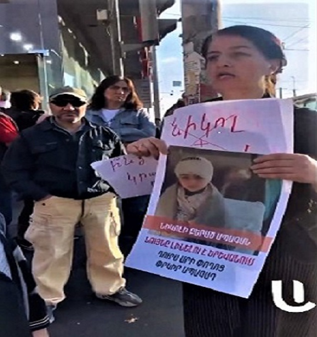 Photo of “kid injured in Karabakh” during rally against Pashinyan
