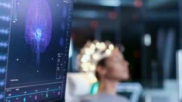 Russian expert: "Person infected with COVID may develop premature aging"