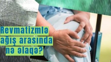 “Revmatizmim varsa, yağış yağacaq”- revmatizmlə yağış arasında nə əlaqə?